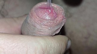 Ureal Insertion I'm Putting a Catheter in My Husband, It Hurts Him