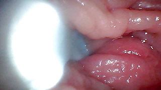 First time: An endoscope reveals the G-spot up close - without mountingl