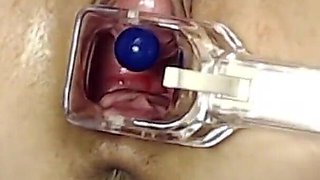 Extreme Pussy Play with Speculum and Peehole Fuck