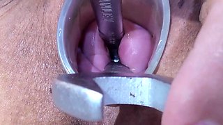 Japanese Extreme Cervix Fucking