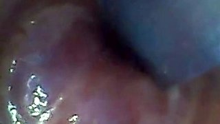 Endoscope POV: Test Tube Cock Urethral Insertion