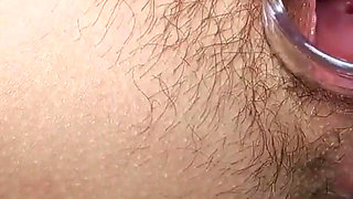 Open pussy using a speculum_orgasm in close up during