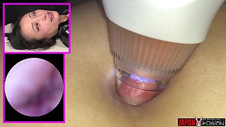 Hana Kano - Extreme Belly Button Exploration Part 2: Suction and Microscopic Observation
