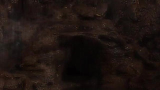 Unexpected Erection in Front of the Nurse