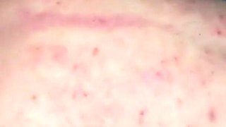 Triple Trampling Training and Torment