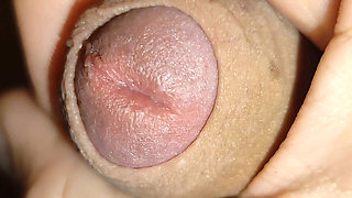 Amazing Dilator Vessel Has Disproportionate Increase.