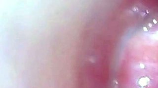Endoscope POV: Test Tube Cock Urethral Insertion