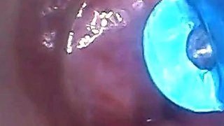 Endoscope POV: Test Tube Cock Urethral Insertion