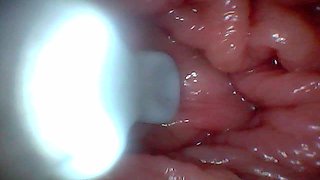 First Time: an Endoscope Reveals the G-spot up Close - Without Mounting!