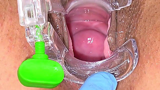 Hairy Pussy of Hot MILF Trinity Black Examined with Speculum