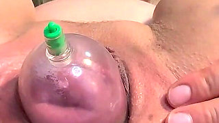 Cervix Show and Pump, Close up Views