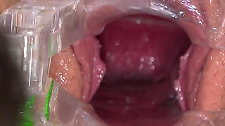 Pussy Exam of Hot College Student Juliia