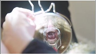 REAL Danish gyno exam. NOT roleplay.