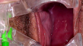 Hairy Mature Pussy Examined by Two Doctors